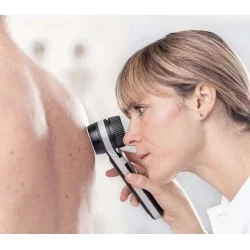 HEINE DELTA 30 Dermatoscope