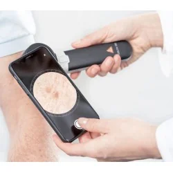 HEINE DELTA 30 Dermatoscope DERManager
