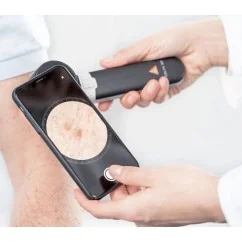 HEINE DELTA 30 Dermatoscope DERManager