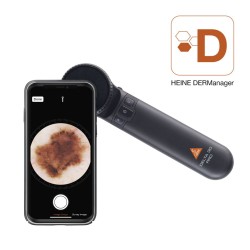 HEINE DELTA 30 PRO Dermatoscope