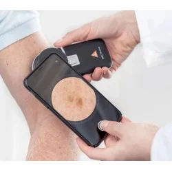 HEINE DELTAone Dermatoscope Set